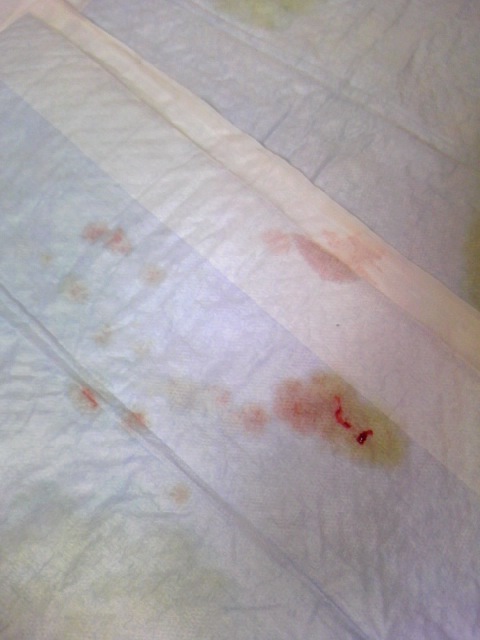 誤飲コレクション！